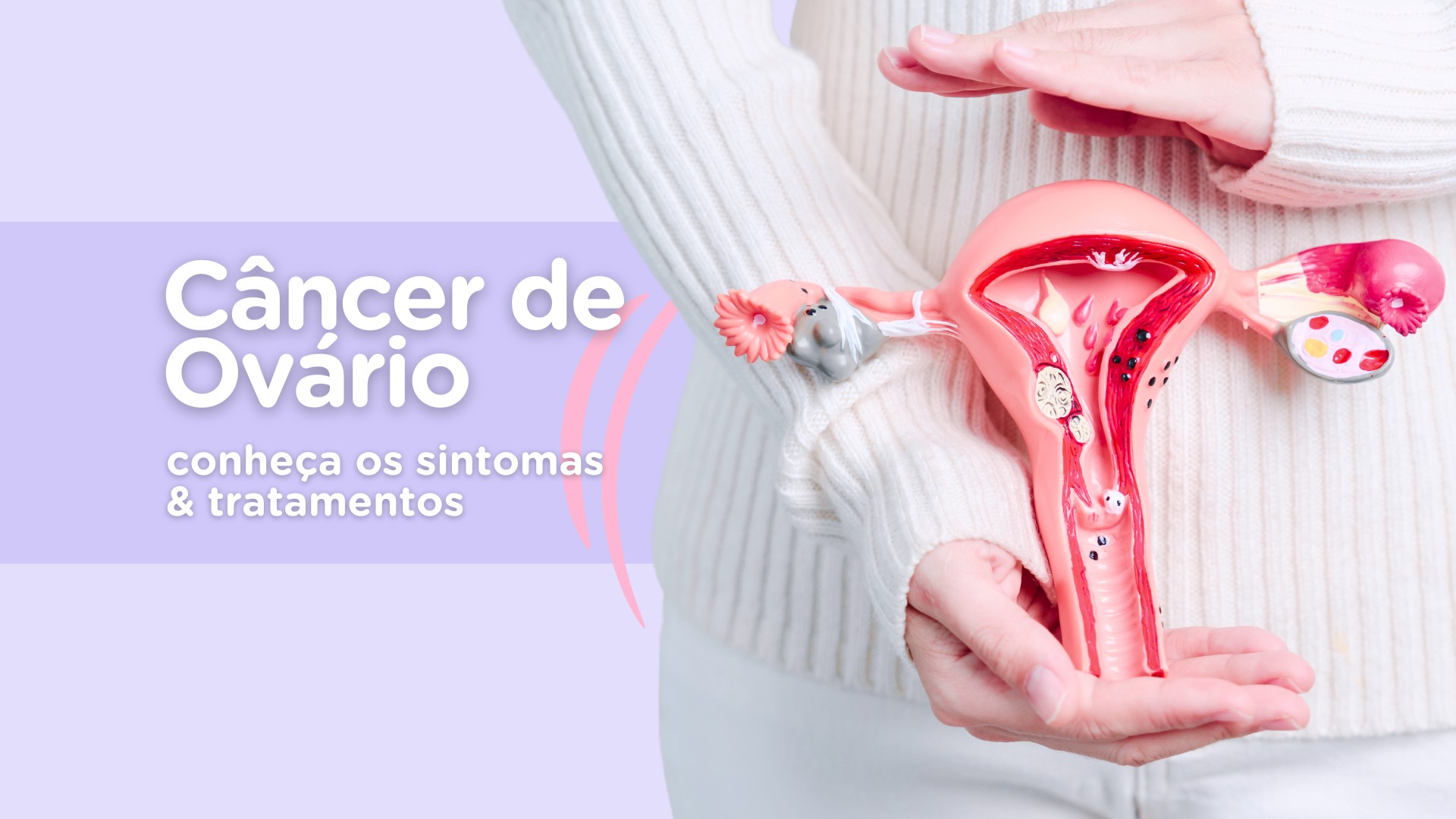 Câncer de ovário: conheça os sinais, sintomas e tratamentos